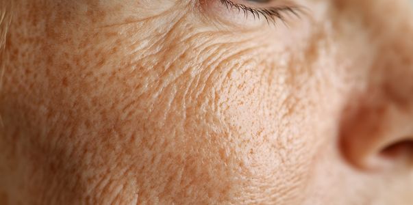 Nie czekaj na zmarszczki działaj profilaktycznie!